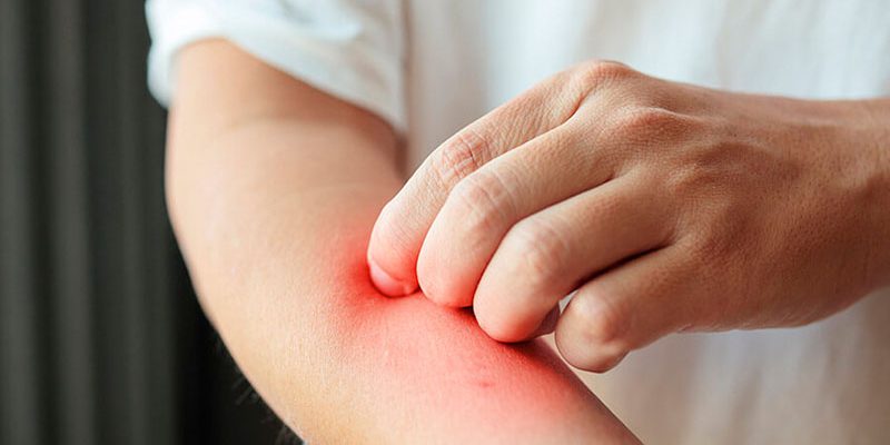 Espondiloartropatias - Dra. Mónica Sarmiento