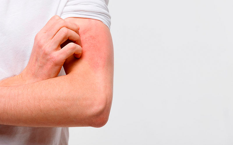 Enfermedades autoinmunes - Dra. Mónica Sarmiento