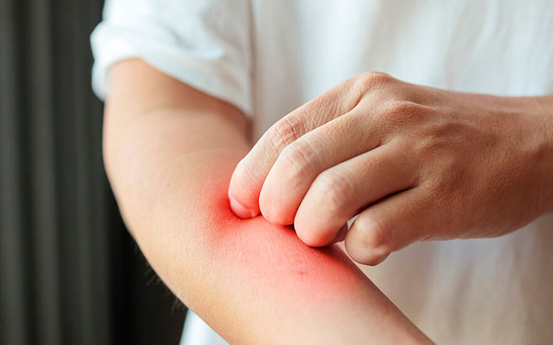 Espondiloartropatias - Dra. Mónica Sarmiento